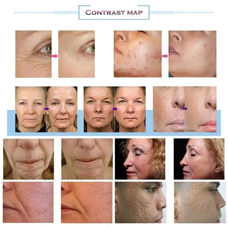 2026 Beauty Facial massage Machine