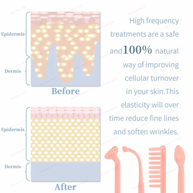 High Frequency Facial  Massage Wand Home Use Skincare Device High Frequency Beauty Care Machine