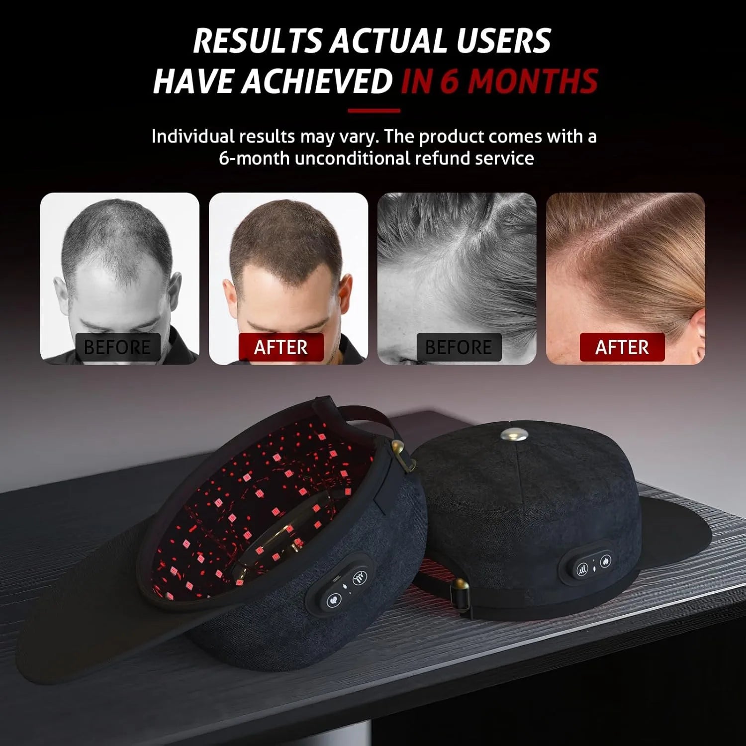 Wireless Laser Cap Hair Growth Device 660nm 850nm Low Level Laser Therapy Hat for Hair Regrowth Anti Hair Loss Treatment LLLT
