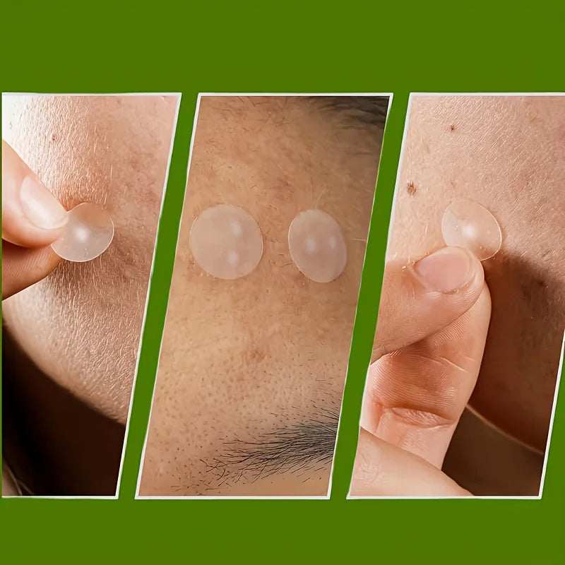 192PCS An invisible high-quality acne patch with strong adhesion, invisible nature and safe for all skin types