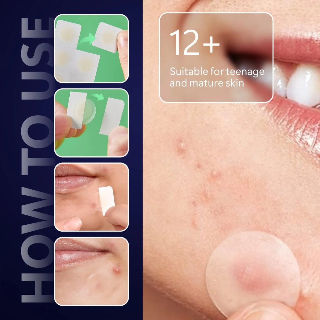 192PCS An invisible high-quality acne patch with strong adhesion, invisible nature and safe for all skin types