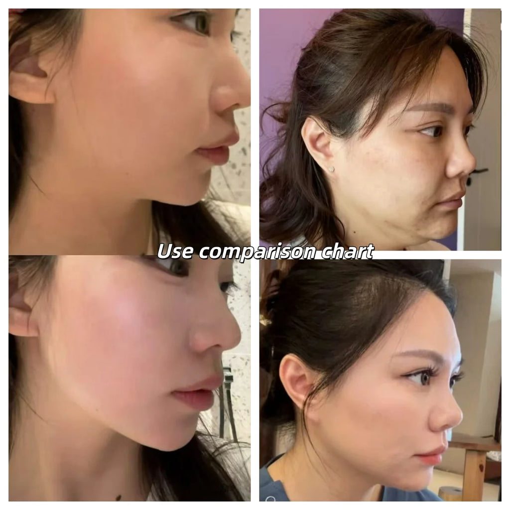Professional EMS Face Lifting Machine Face Sculpting ems Wrinkle Removal RF Skin Tightening Stimulator