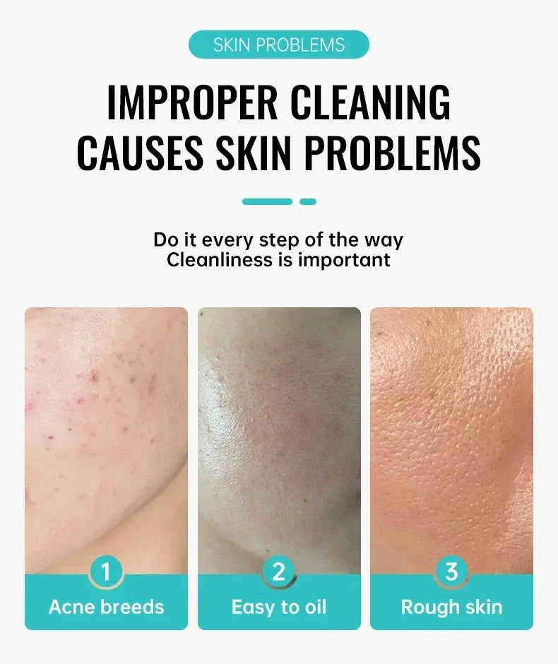 Salicylic Acid Acne Treatment Face Cream Repair Pimple Spots Deep Cleaning Pore Anti-acne Scar Oil Control Moisturizer Skin Care