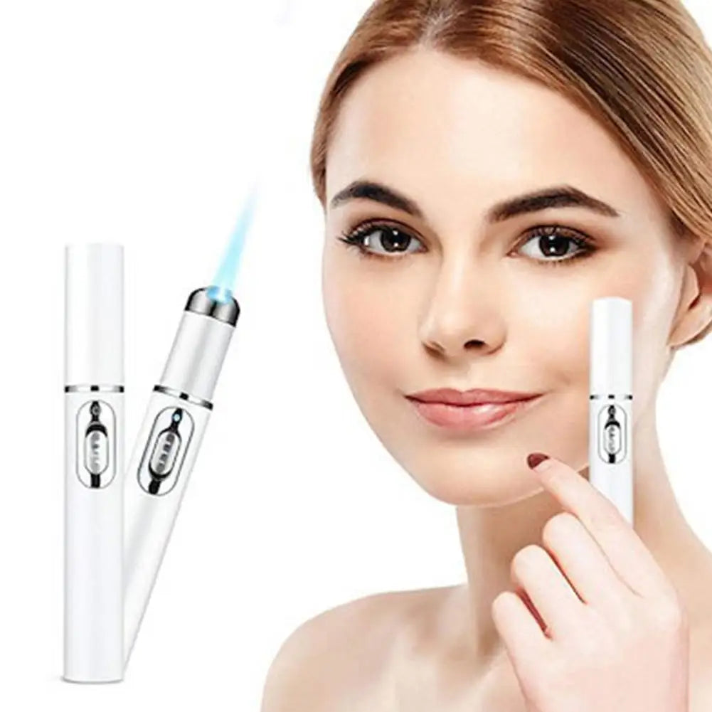 Blue Light Acne Pen Heated Eye Massager Eye Massage Instrument for Dark Circles Eye Bags Puffiness Under Eyes Beauty Pen