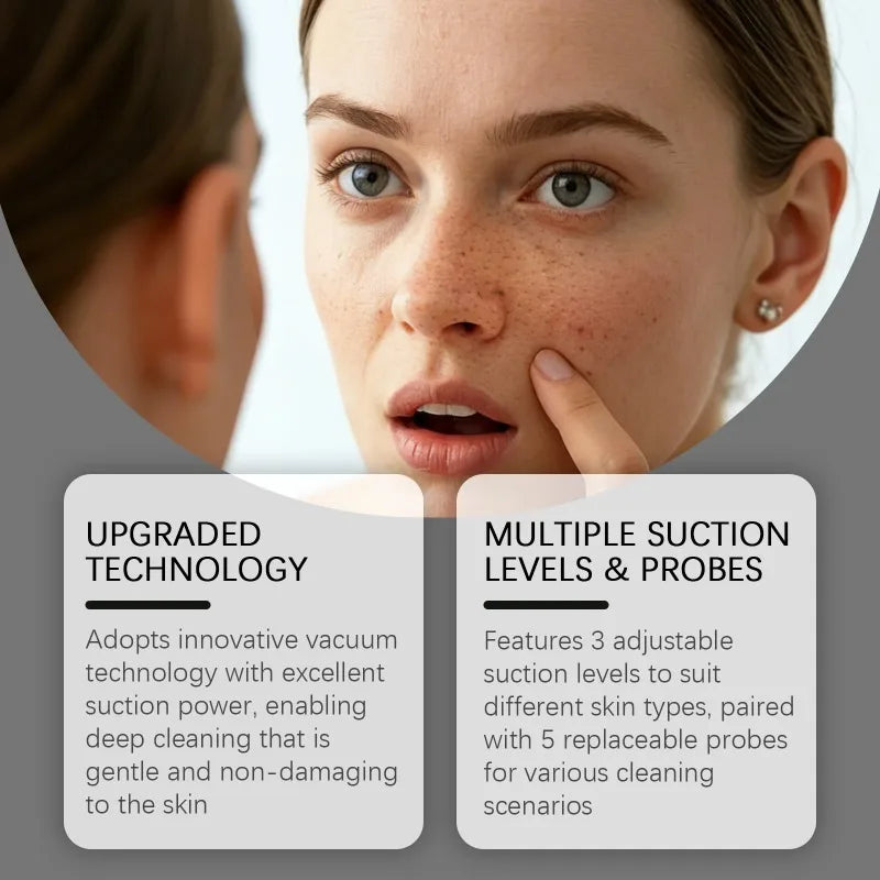 Blackhead Remover Pore Vacuum, Facial Pore Cleaner - 5 Suction Power, 5 Probes, USB Rechargeable