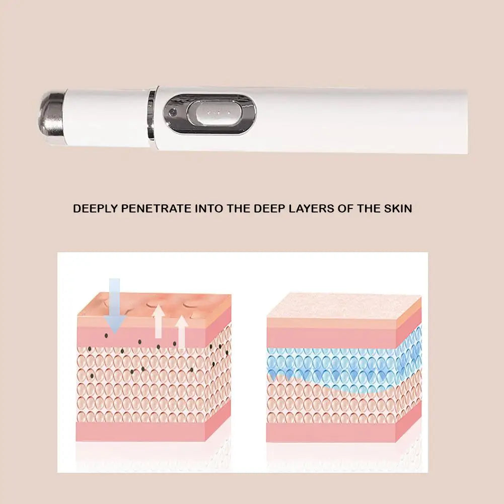 Blue Light Acne Pen Heated Eye Massager Eye Massage Instrument for Dark Circles Eye Bags Puffiness Under Eyes Beauty Pen