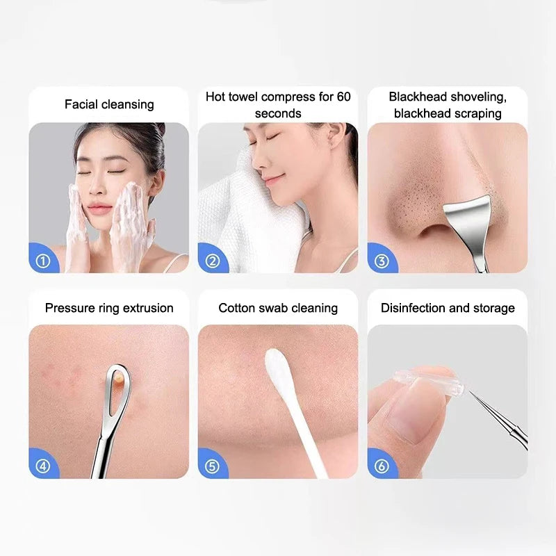 Blackhead Acne Remover Pimple Popper Tool Acne Needle Removing Hair Follicle Cleaning Whitehead Nose Face Blemish Extractor