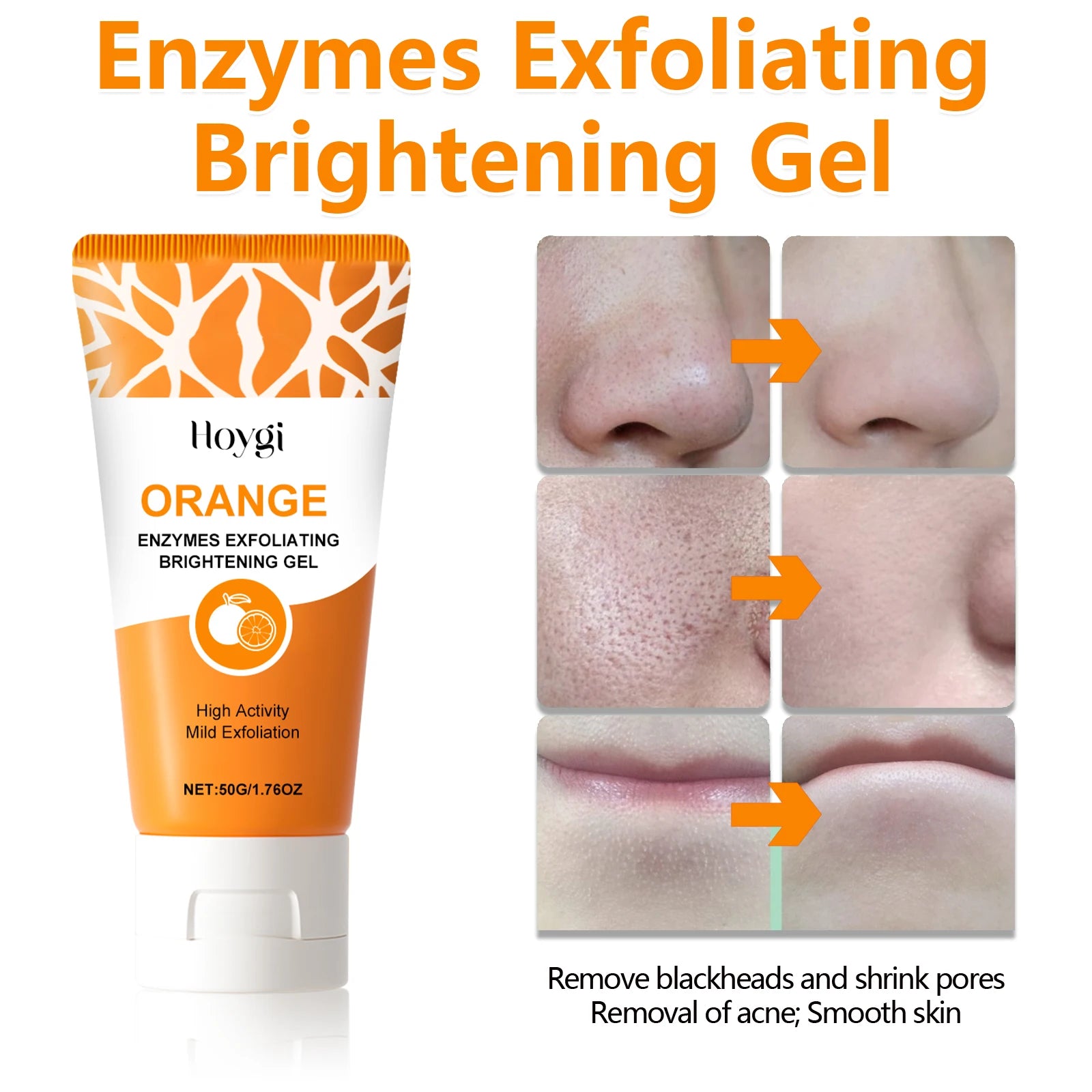 Blackhead Remover Gel Exfoliating Cleansing Gel Deep Pore Cleanser Remove Dead Skin Oil Control Shrink Pores Facial Skin Care