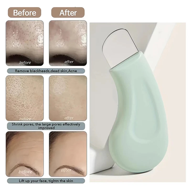 Deep Cleansing Beauty Tool Professional Blackhead Whitehead Remover Effective Pore Cleaner for Nose and Face Practical Skin Care