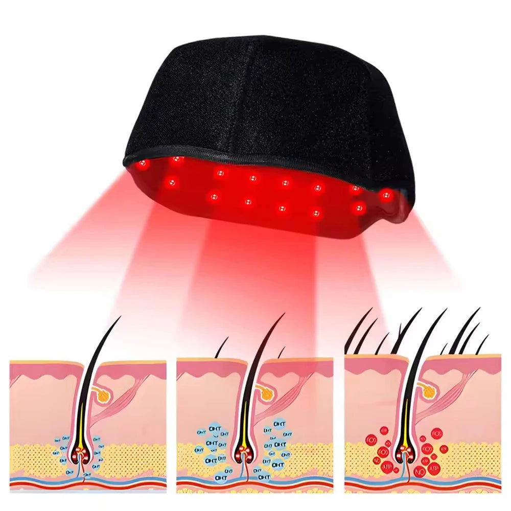 New Infrared LEDs 650nm&850nm Red Light Therapy Hair Growth Cap For Hair Regrowth Anti Hair Loss Relax Scalp Anti-inflammatory