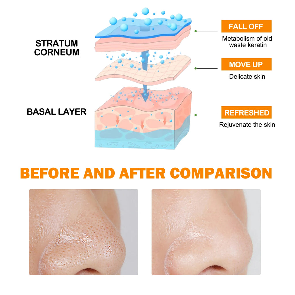 Blackhead Remover Gel Exfoliating Cleansing Gel Deep Pore Cleanser Remove Dead Skin Oil Control Shrink Pores Facial Skin Care