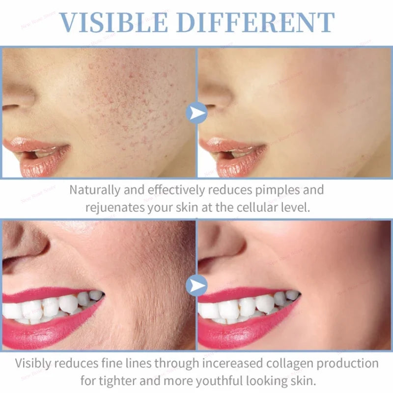 High Frequency Facial  Massage Wand Home Use Skincare Device High Frequency Beauty Care Machine