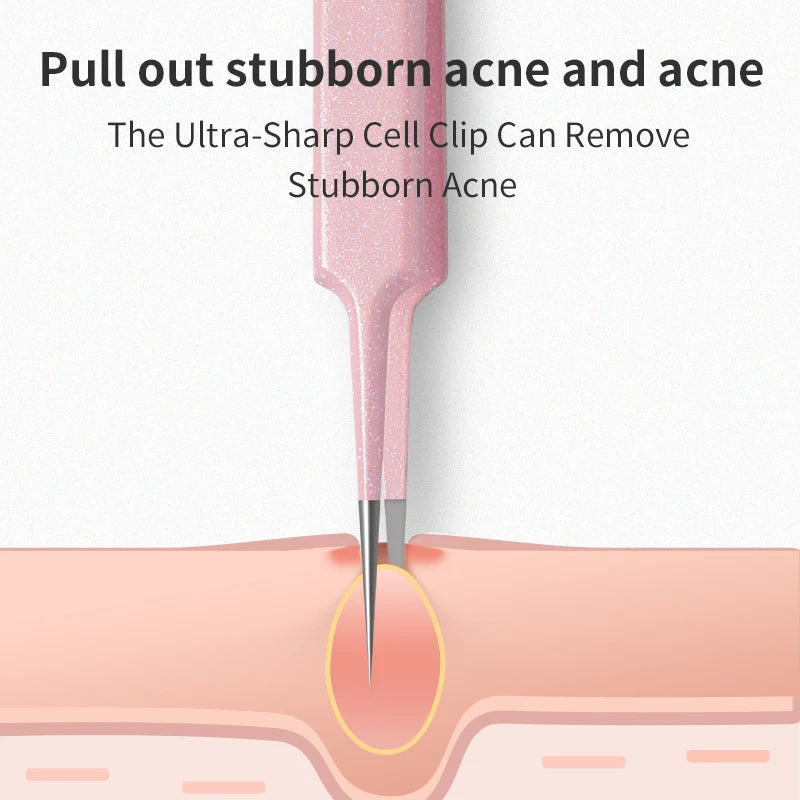 Facial Acne & Blackhead Remover Beauty Set Pimple Extractor Kit