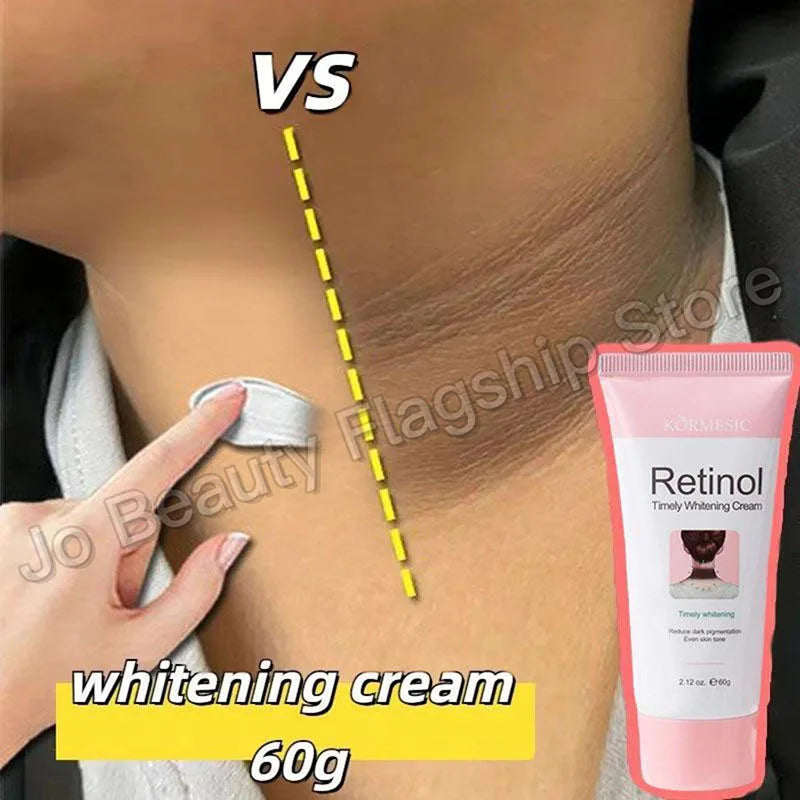 Retinol Whitening Cream Private Parts Underarm Bleaching Neck Lift  Firm Butt Knee Brighten Inner Thigh Dark Remove Melanin 60g