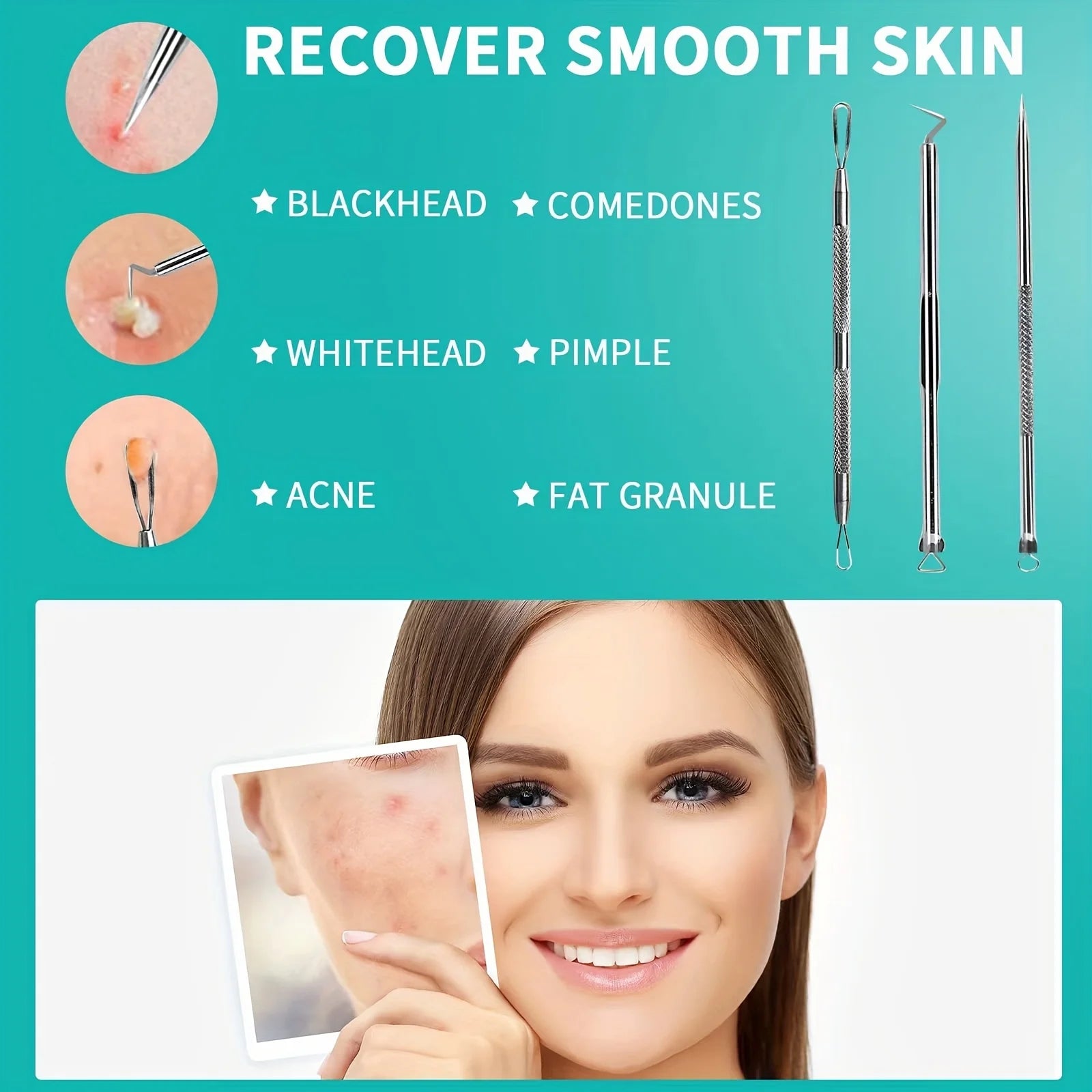 3pcs Pimple Popper Tool, Stainless Steel Pimple Extractor, Blackhead Tweezers, Comedones Extractor Acne Removal Kit for Blemish,