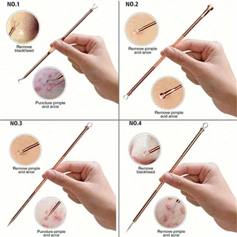 4Pcs Remover Pimple Comedone Extractor Tool Acne Removal Kit Treatment for Blemish,Risk Free Removal of Facial Blemishes