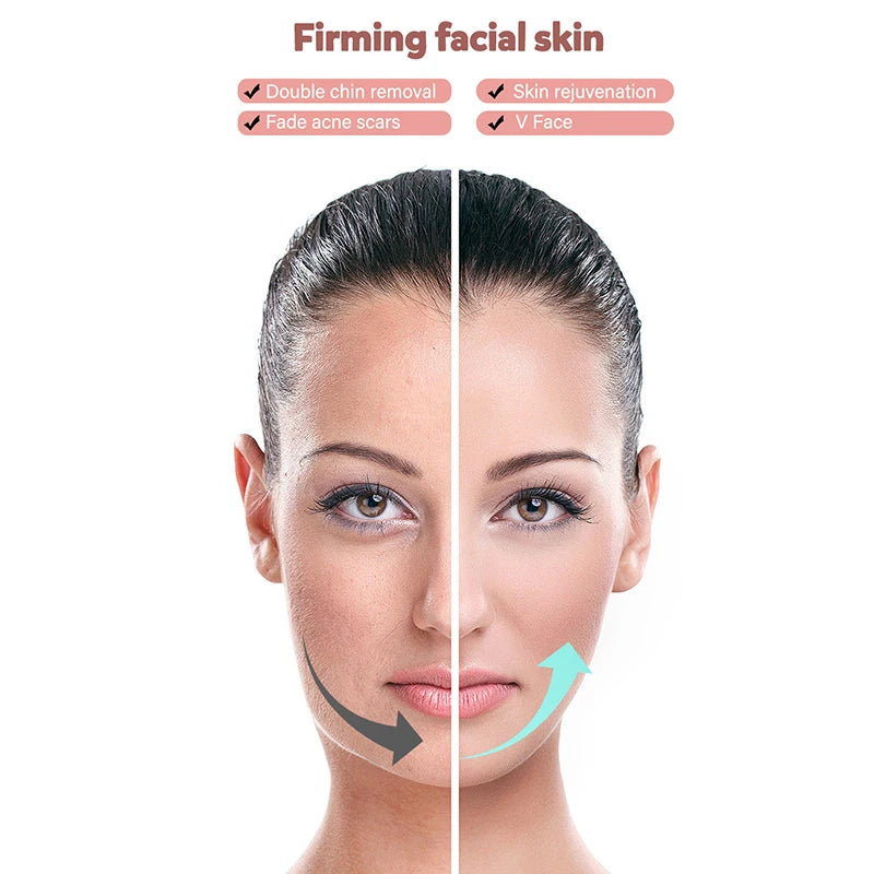 Micro-current Facial Shaping Device, Tightening Double Chin, LED V-face Beauty Device, High-frequency Vibration Facial Massager