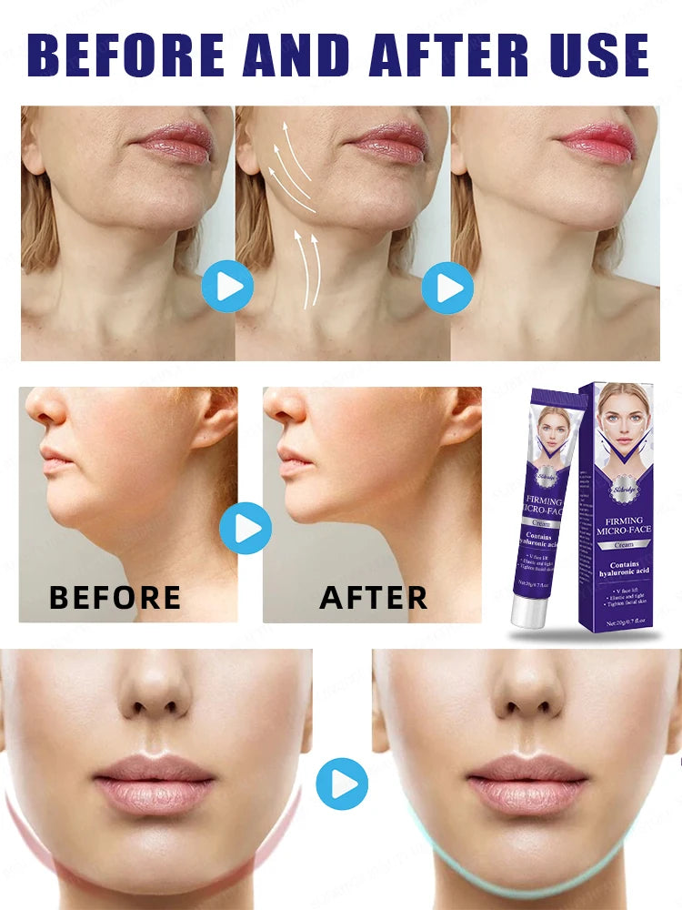 Remove double chin