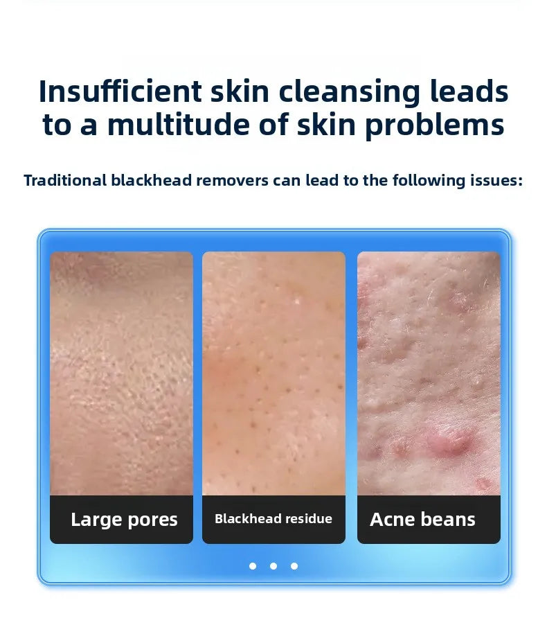 Pore Vacuum Blackhead Remover Women and Men Facial Cleaning Beauty Equipment Facial Pore Cleaning Oxygen Injection Instrument
