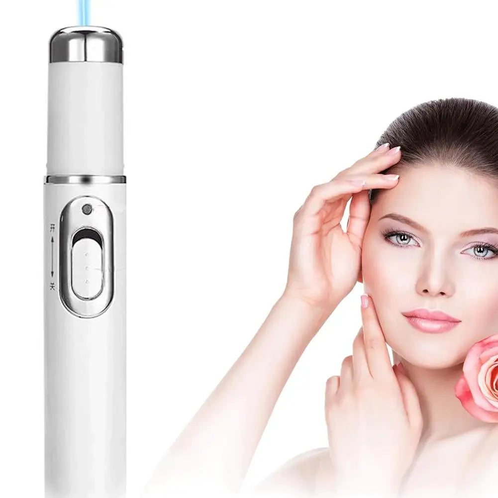 Blue Light Acne Pen Heated Eye Massager Eye Massage Instrument for Dark Circles Eye Bags Puffiness Under Eyes Beauty Pen