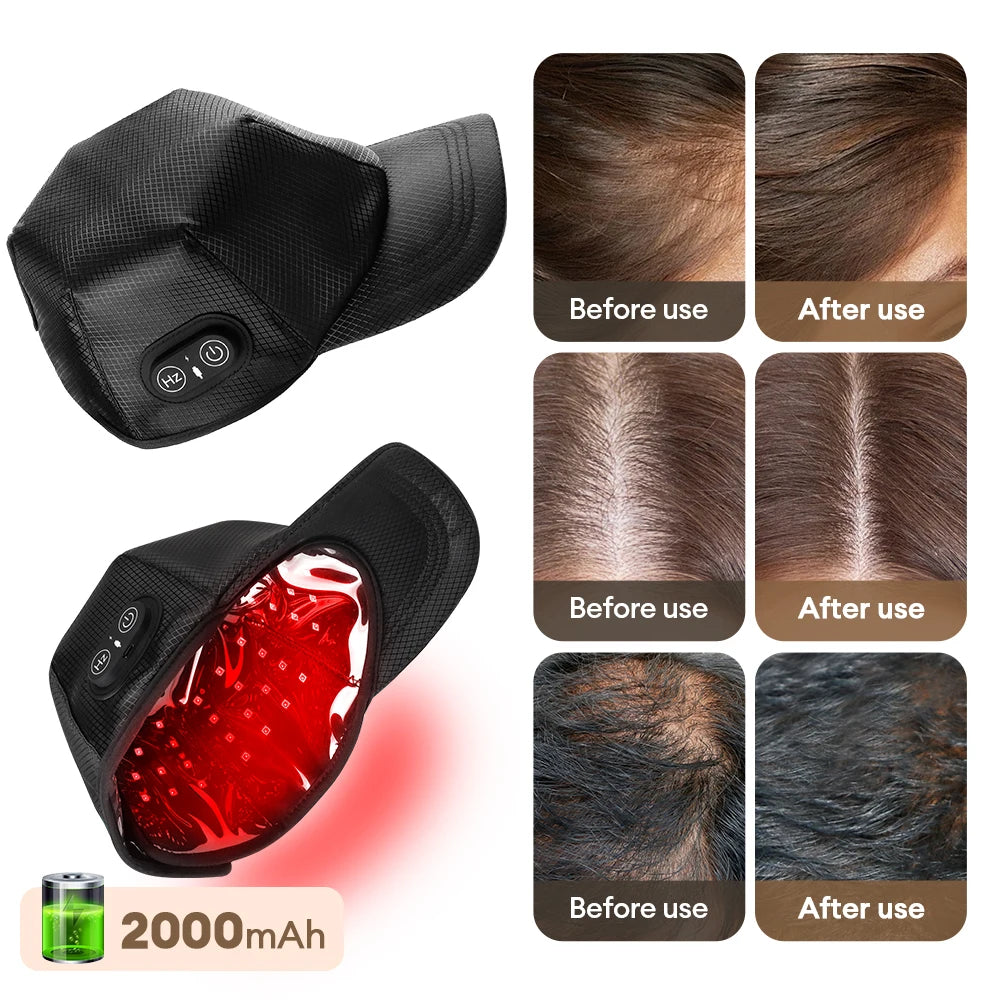 Red Light 650nm+850nm Infrared Hair Growth Cap Hair Loss Treatment Hat Anti Hair Loss Restore Hair Thickness Hair Regrowth Care