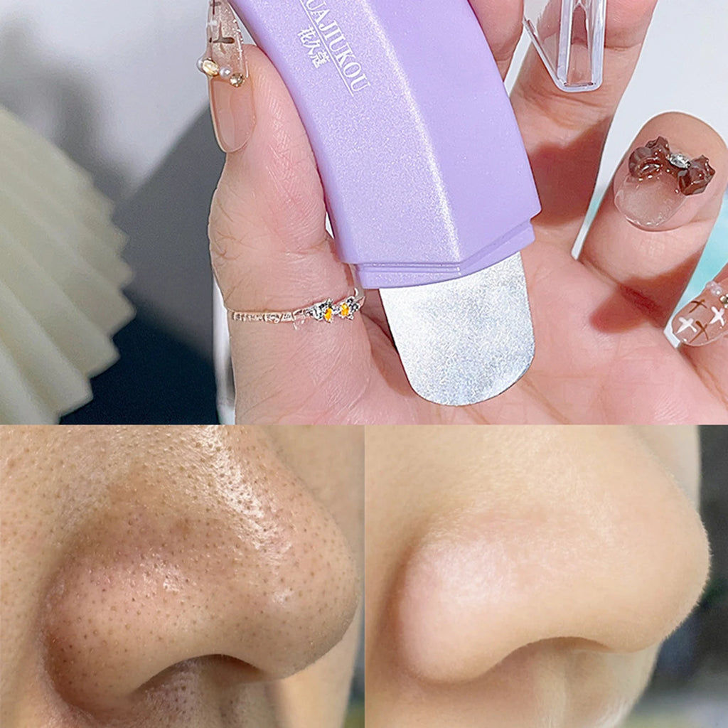 Ergonomic Blackhead Remover Stainless Steel Single/Dual-Ended Pore Cleaner Tool Comedone Extractor for Nose & Face