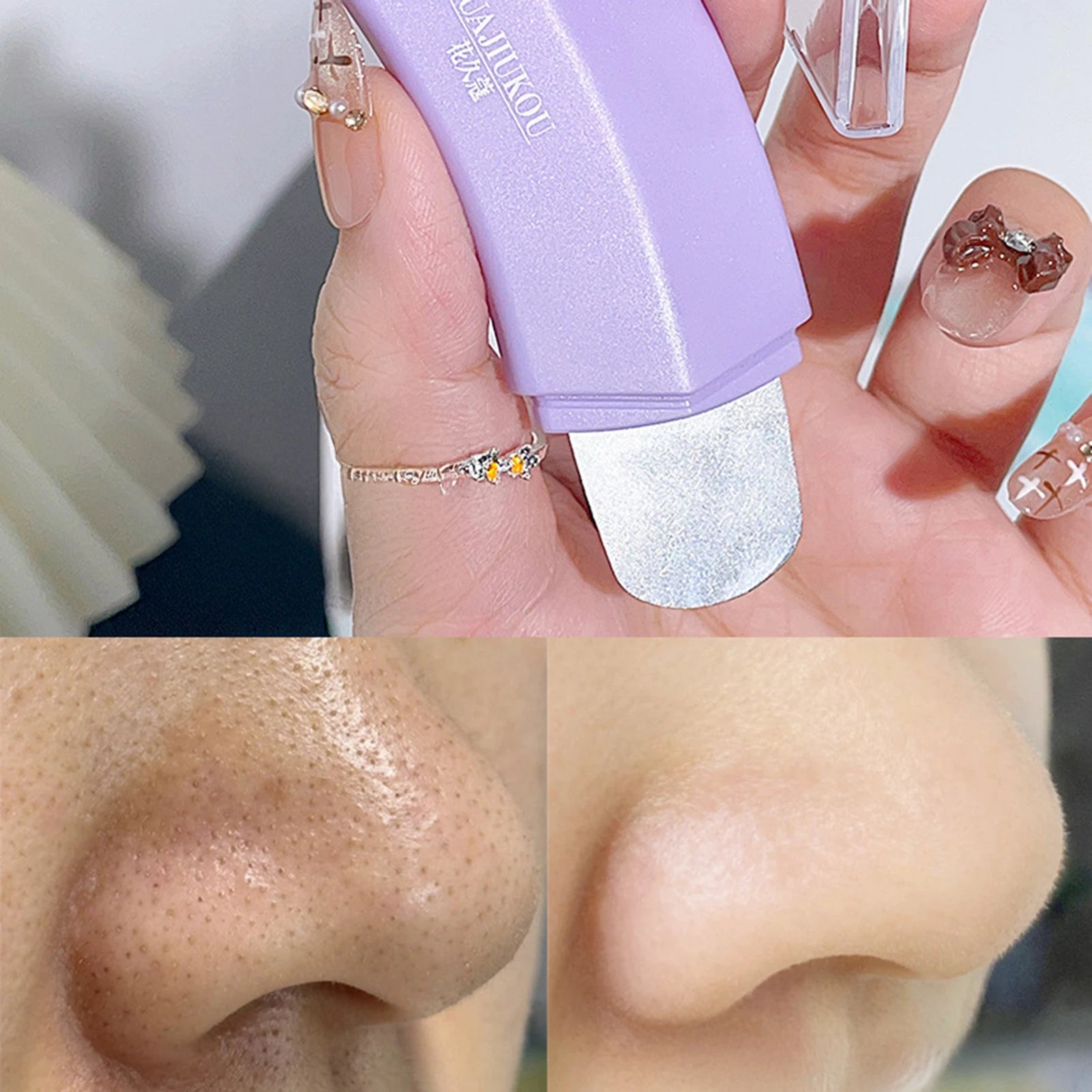 Ergonomic Blackhead Remover Stainless Steel Single/Dual-Ended Pore Cleaner Tool Comedone Extractor for Nose & Face