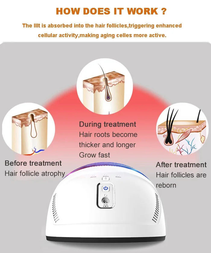 Factory Supply KN-8000B Cap Hair Growth Device Hair restoration Kernel Hair  Helmet