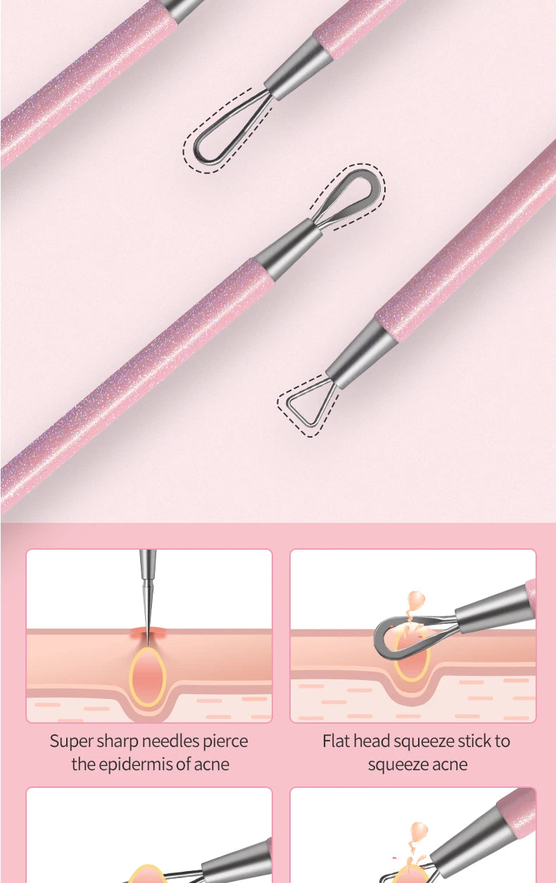 Facial Acne & Blackhead Remover Beauty Set Pimple Extractor Kit
