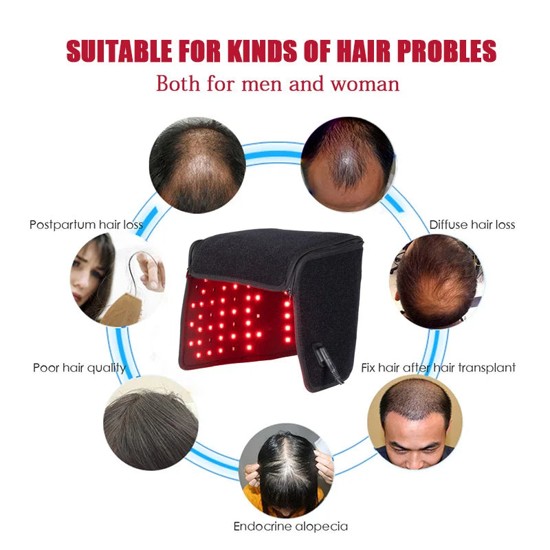 Hair Growth Cap Reduces Oiliness Strengthens Hair Roots Penetrates Deep Into Hair Follicles Relieves Fatigue Anti-Hair Loss Hat