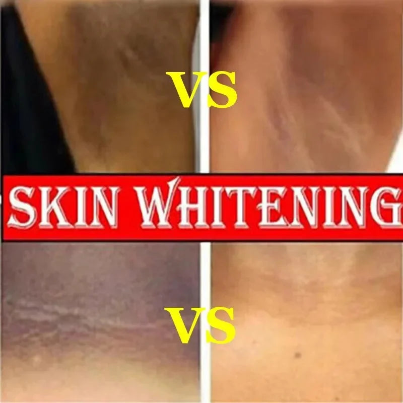 Retinol Whitening Cream Private Parts Underarm Bleaching Neck Lift  Firm Butt Knee Brighten Inner Thigh Dark Remove Melanin 60g