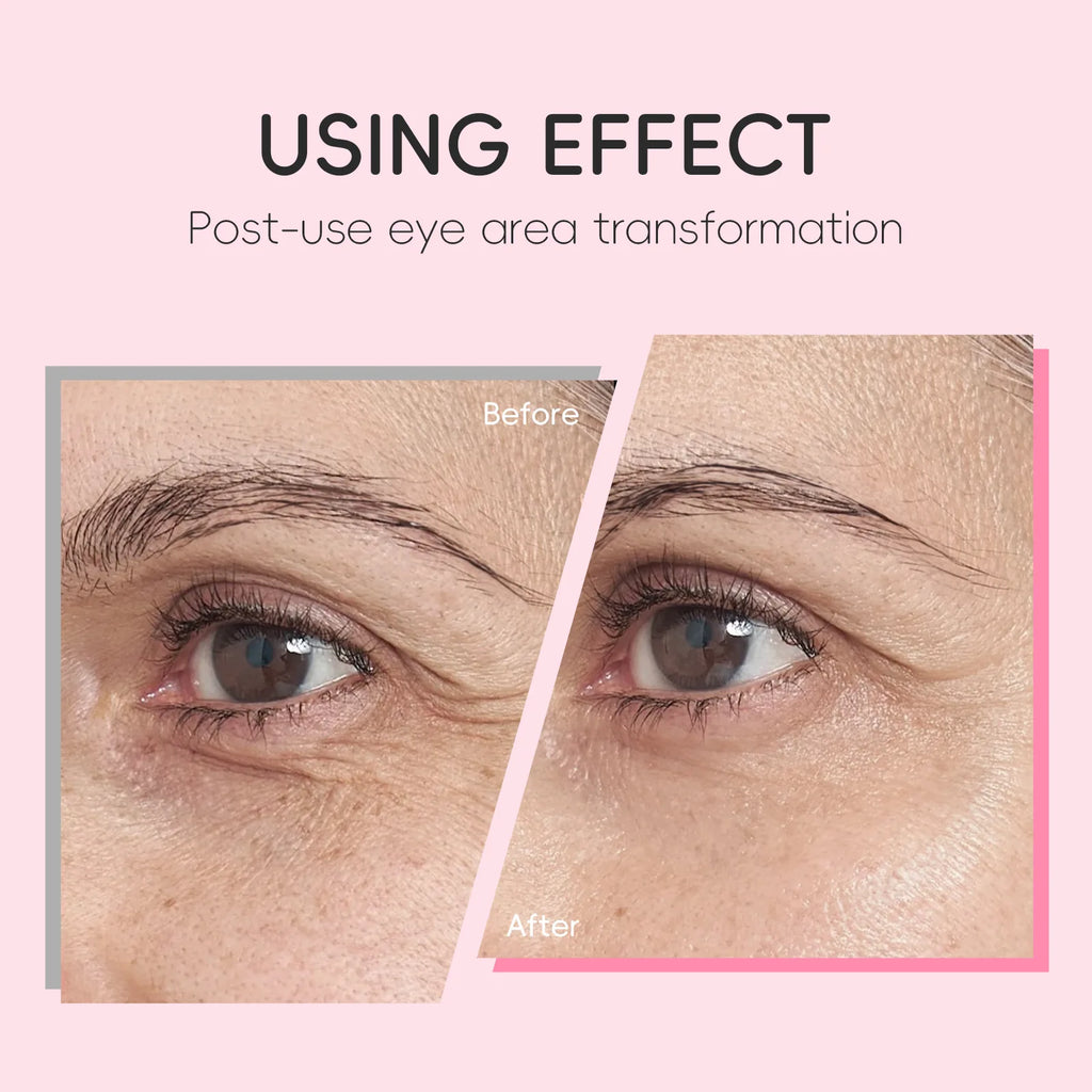  LAIKOU Sakura Eye Serum Roller Massage Anti-Aging,Hydrating & Brightening Eye Dark Circle & Puffiness Reduction Eye Cream 15ml