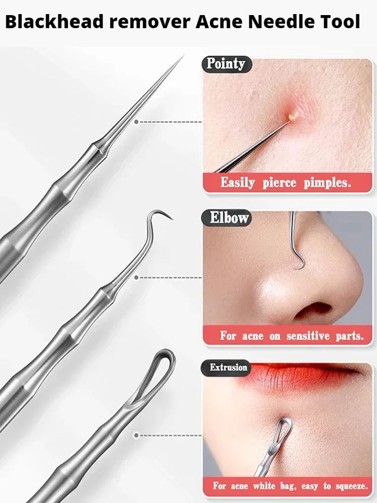 Beauty Artifact Blemish Extractor Remover Needle Tool Acne Blackhead Removal Needles Pimples Blackhead Clip Tweezers
