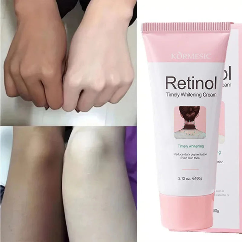 Retinol Whitening Cream Private Parts Underarm Bleaching Neck Lift  Firm Butt Knee Brighten Inner Thigh Dark Remove Melanin 60g