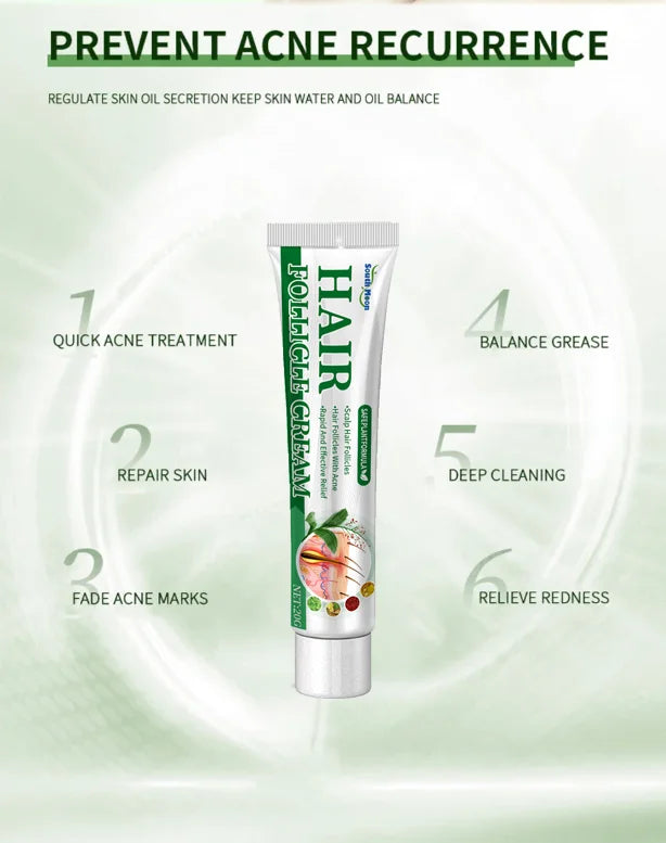 Anti-Acne Cream Effectively Removes Skin Nodules Pustules Cysts Papules Blackheads Men And Women Acne Skin Care Essence Cream