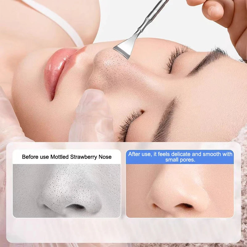Blackhead Acne Remover Pimple Popper Tool Acne Needle Removing Hair Follicle Cleaning Whitehead Nose Face Blemish Extractor