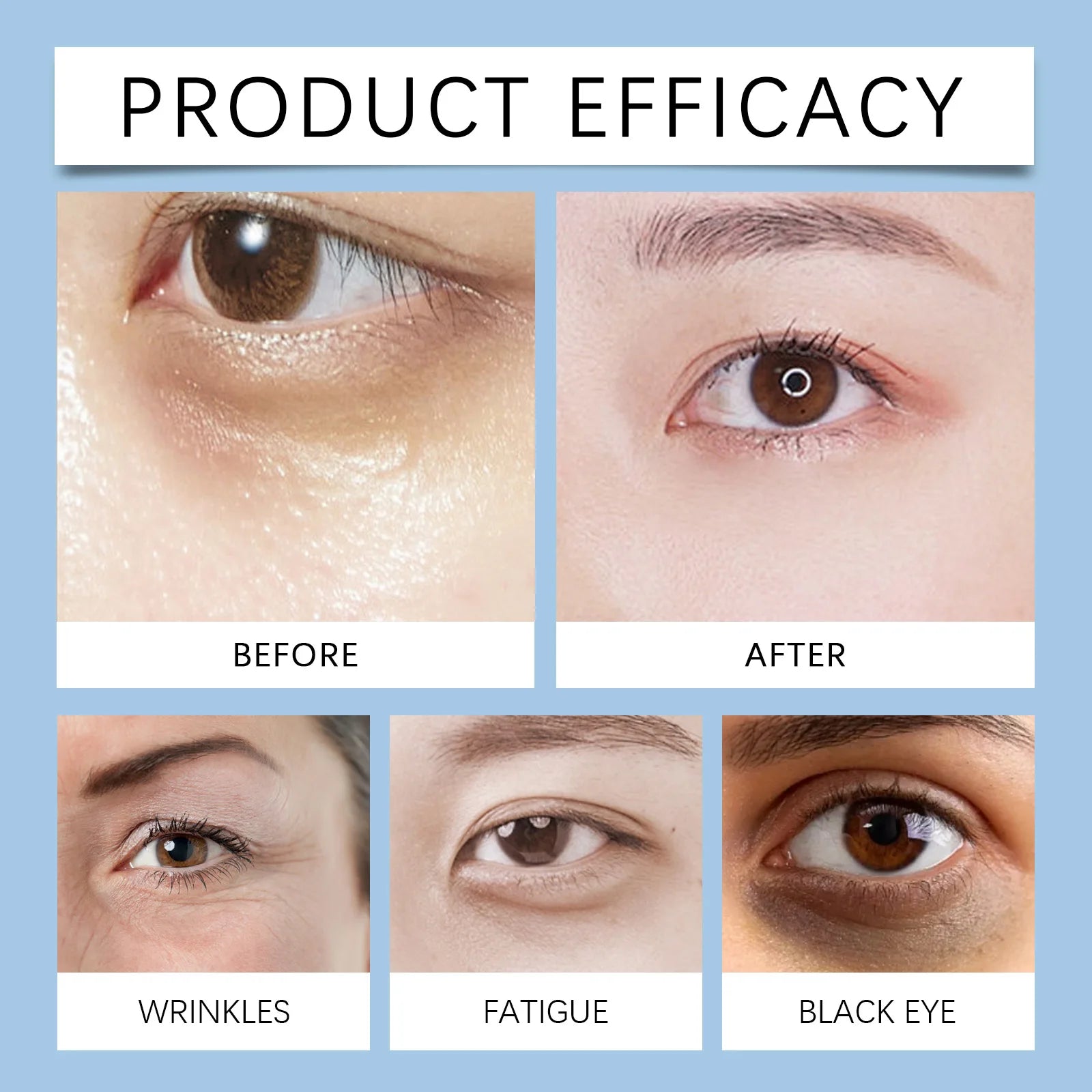 Moisturizing Eye Cream: Gentle, Soft and Hydrating Care for the Eye Area. Apply and Massage.