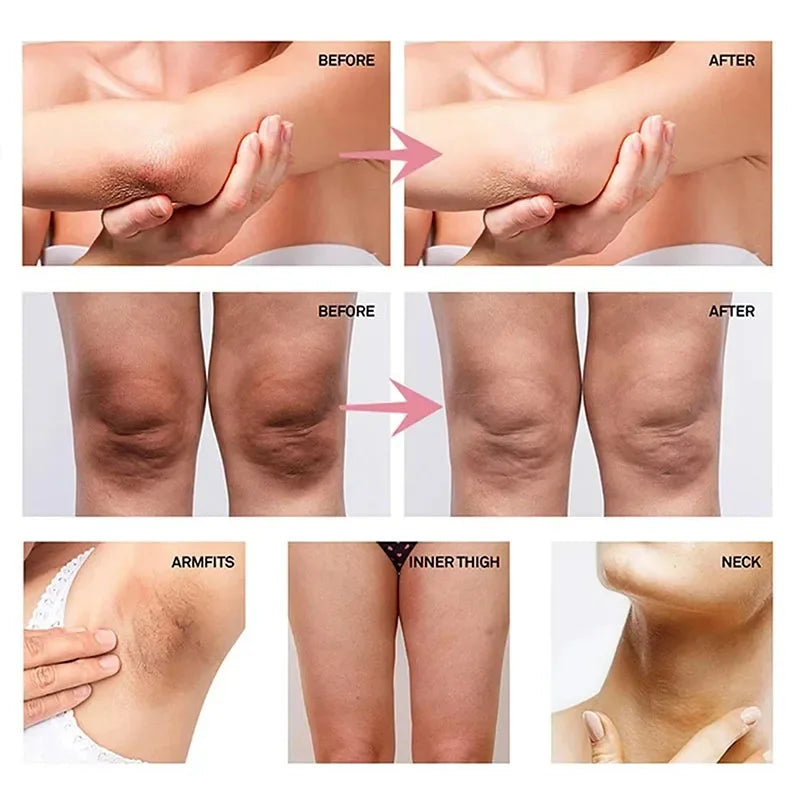Retinol Whitening Cream Private Parts Underarm Bleaching Neck Lift  Firm Butt Knee Brighten Inner Thigh Dark Remove Melanin 60g