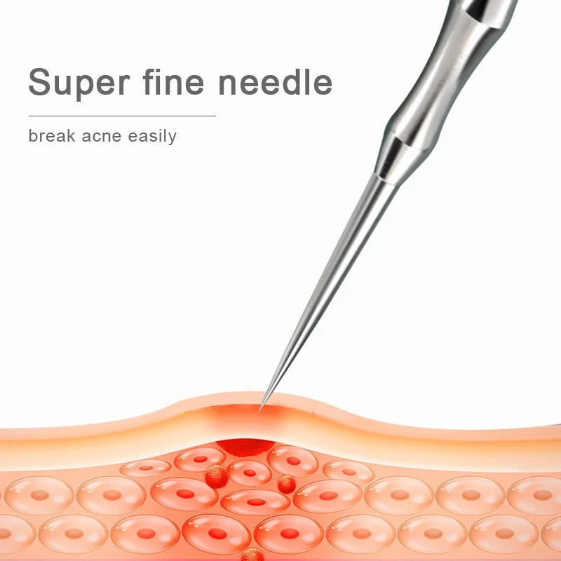 Beauty Artifact Blemish Extractor Remover Needle Tool Acne Blackhead Removal Needles Pimples Blackhead Clip Tweezers