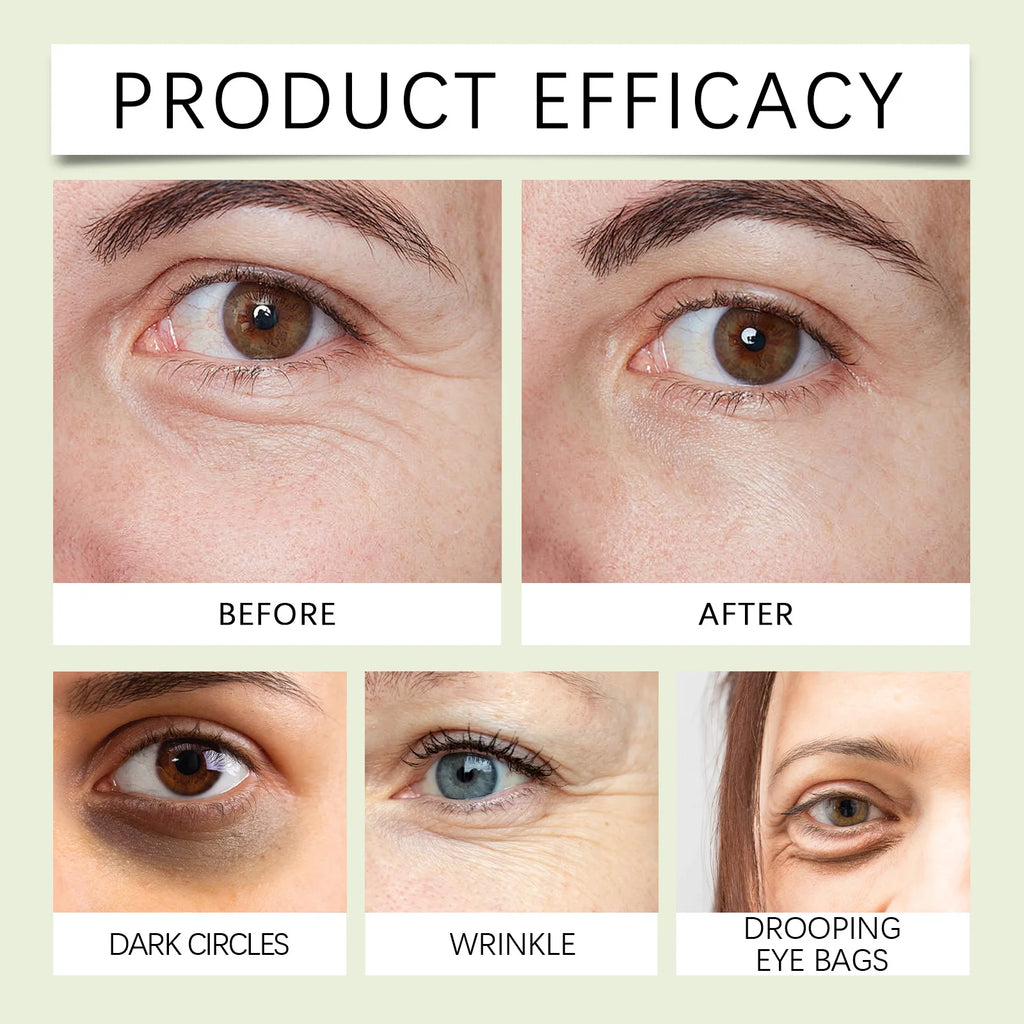 Collagen Eye Serum Cream Anti Dark Circles Eye Bags Eyes Puffy Repair Brightening Tighten Lifting Moisturizing Eye Roller Serum