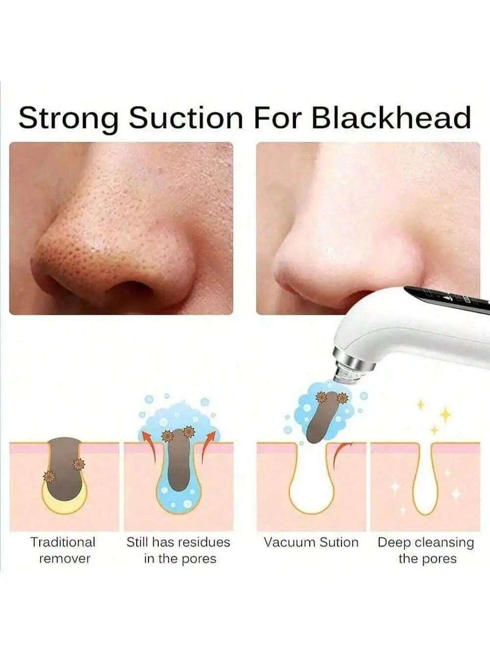 Pore Vacuum Blackhead Remover Women and Men Facial Cleaning Beauty Equipment Facial Pore Cleaning Oxygen Injection Instrument