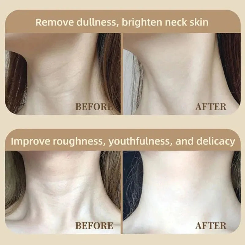 2026 Neck LED Lift Mask Photon Anti-Wrinkle Skin Tightening Neck Beauty Device Skin Brighten Rejuvenation Neck Wrinkle Remover