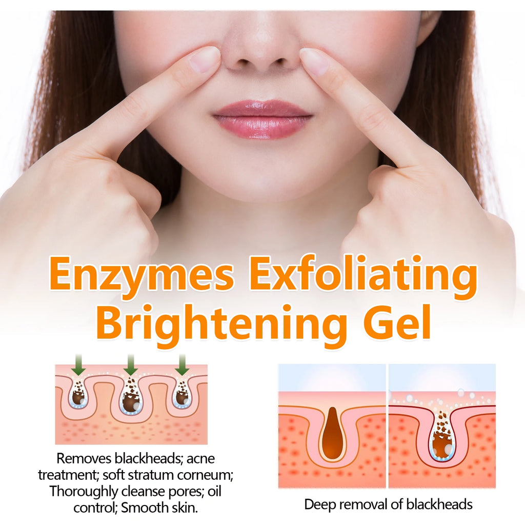 Blackhead Remover Gel Exfoliating Cleansing Gel Deep Pore Cleanser Remove Dead Skin Oil Control Shrink Pores Facial Skin Care