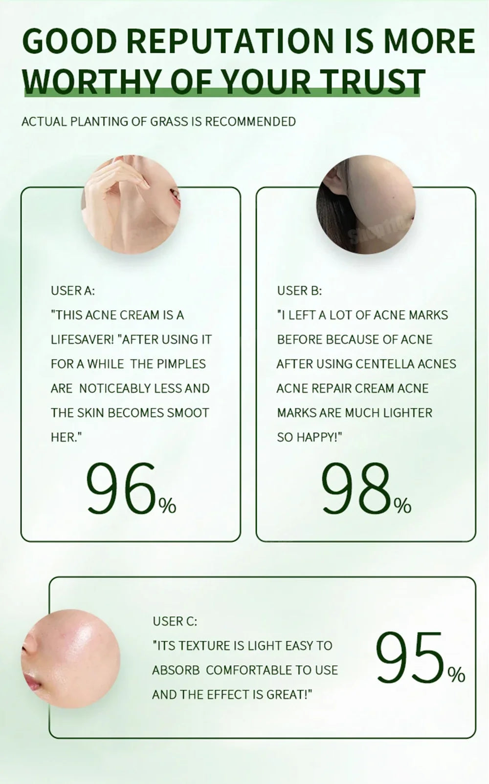 3RD Anti-Acne Cream Effective Removes Skin Nodules Pustules Cysts Papules Blackheads Men and Women Acne Skin Care Essence Cream