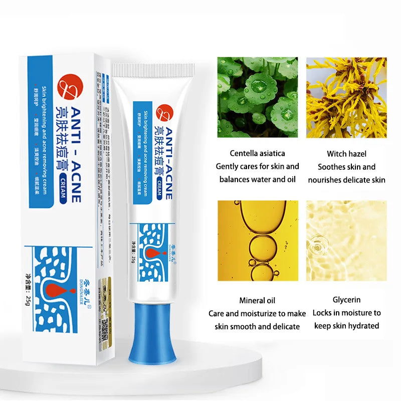 Anti-acne Treatment Cream Salicylic Acid Acne Deep Cleaning Pore Repair Pimple Spots Shrinking Oil Control Moisturizer Skin Care
