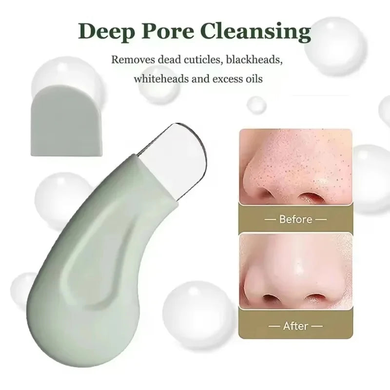 Deep Cleansing Blackhead and Whitehead Removal Tool Skin Pore Cleaner Skin Care Beauty Tools Blackhead Scraper Silicone New