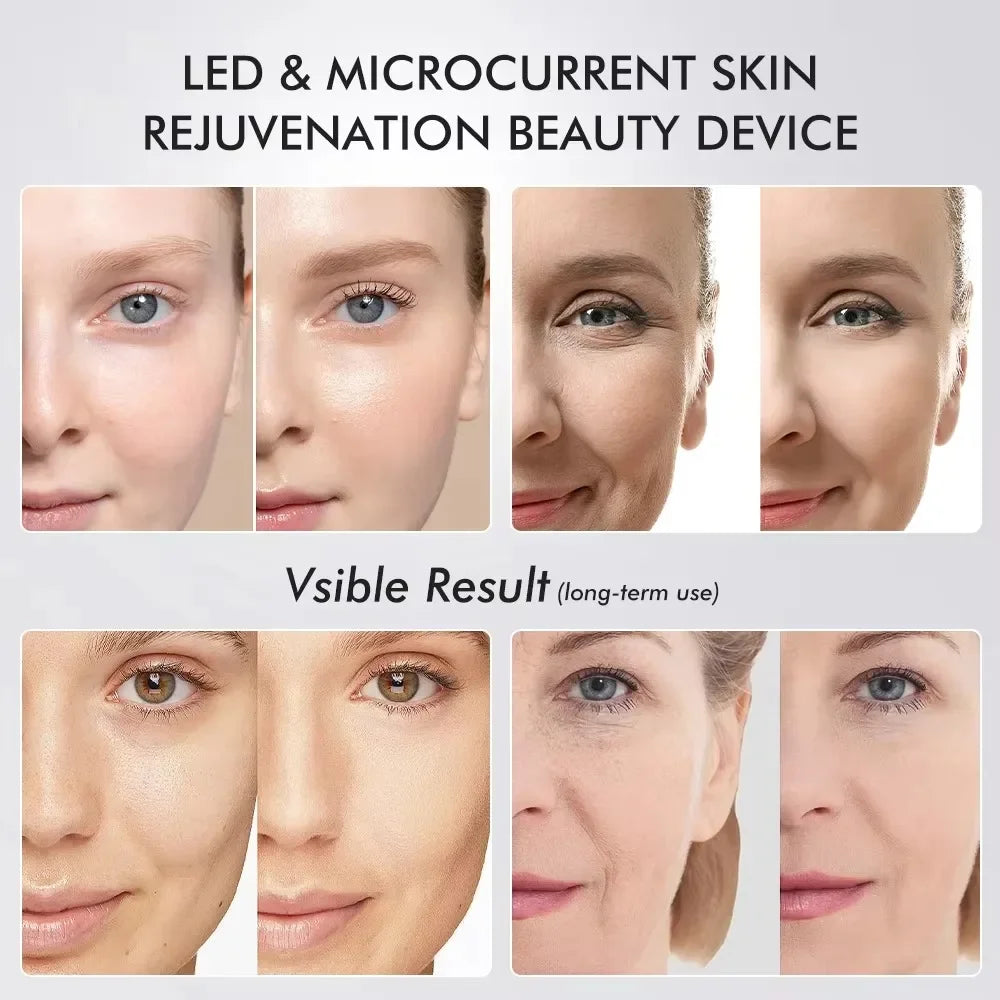 2025 Age Booster Pro Home Skincare Anti-aging Beauty Device Portable Light Therapy Essentials Acne Treatment Device