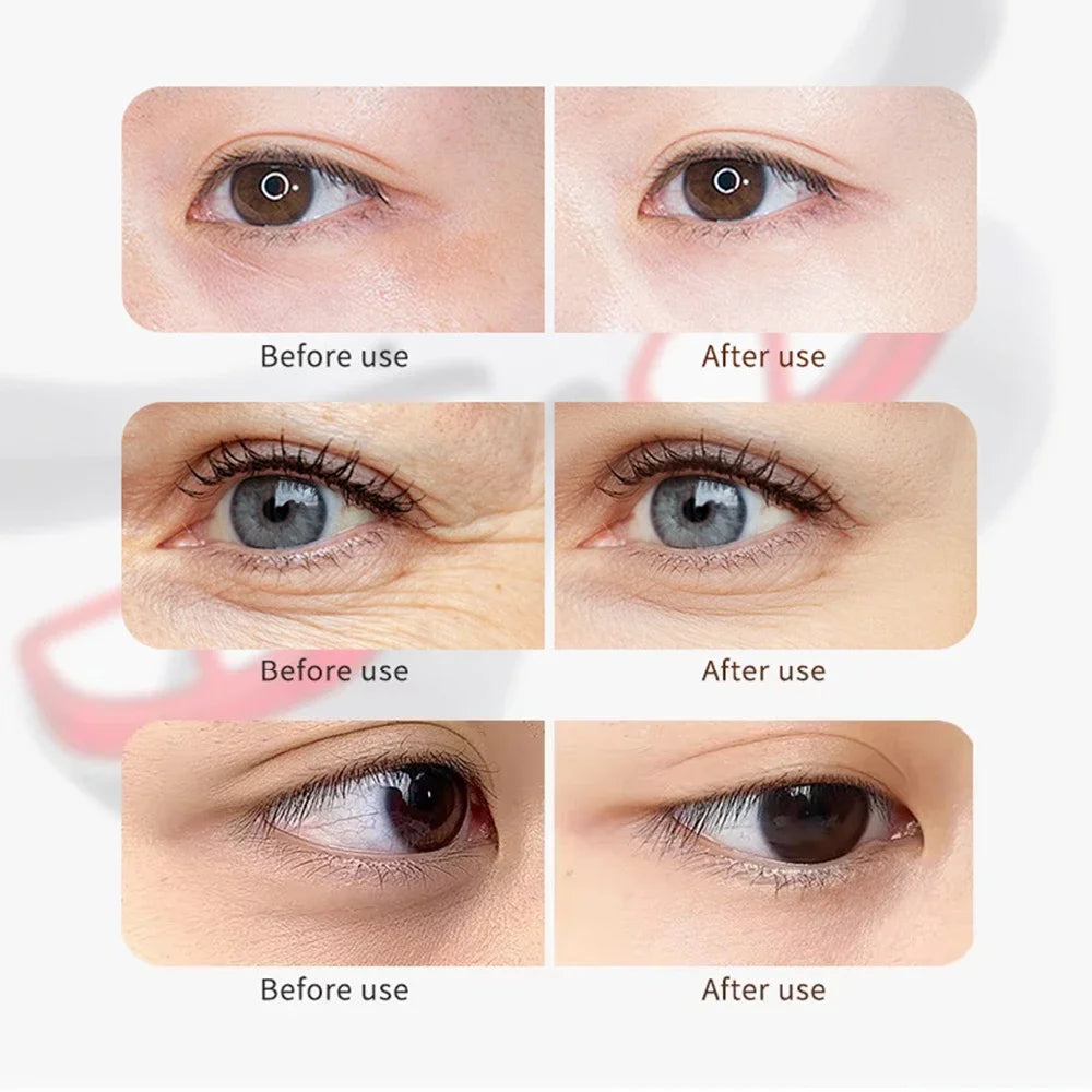 3D Eye Massager Anti-Aging Eye Massager Eyes Fatigue Relief Relaxation Relieve Dark Circles EMS Eye Care Massage Eye Bag Removal