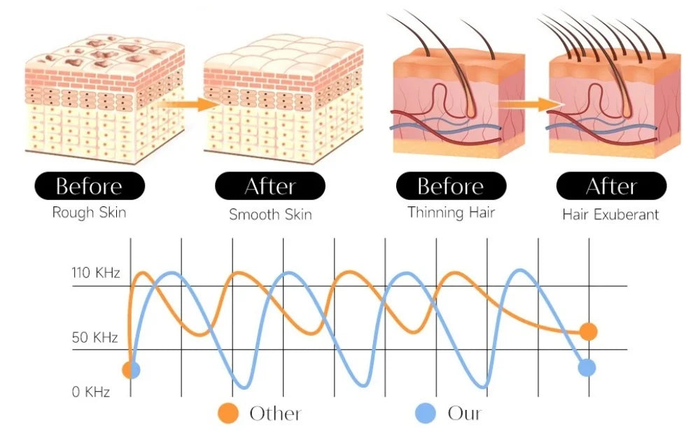 Portable High-Frequency and Microcurrent Electrotherapy Device, Acne Removal and Beauty Comb