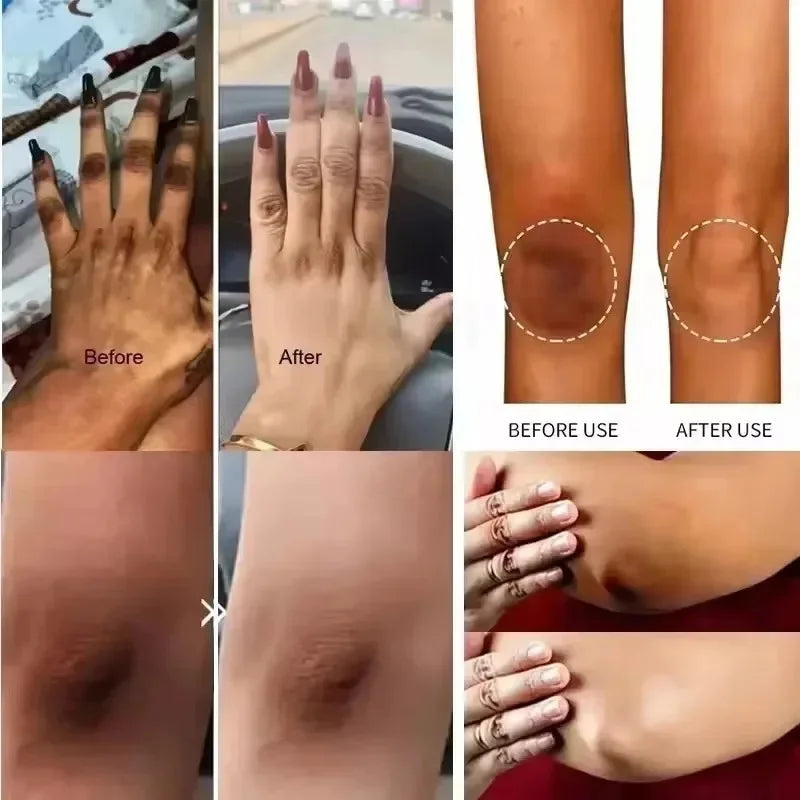 Retinol Whitening Cream Private Parts Underarm Bleaching Neck Lift  Firm Butt Knee Brighten Inner Thigh Dark Remove Melanin 60g